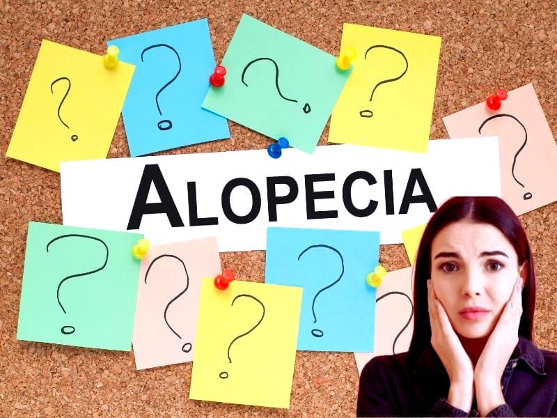 Worried woman with 'Alopecia' sign and question marks pinned on corkboard, showing hair loss concern.