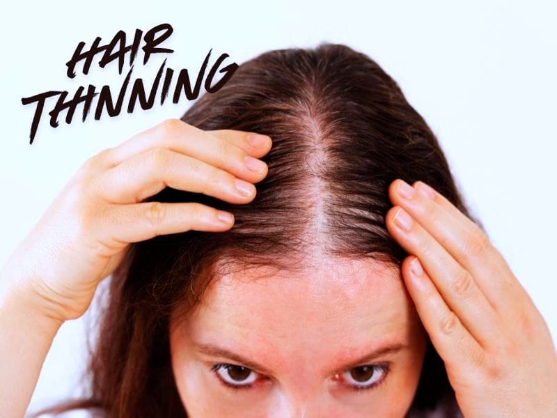 Woman inspecting scalp for hair thinning—visible part line shows signs of hair volume loss.