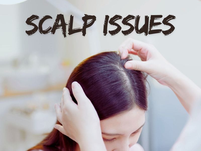 Woman parting her hair to examine her scalp, highlighting possible scalp health or hair thinning concerns.
