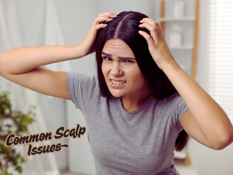 Woman scratching itchy scalp showing signs of irritation – common scalp issues and hair health concerns