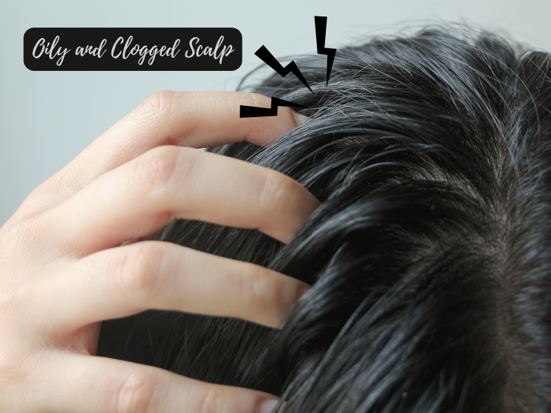 Close-up of fingers parting oily, congested scalp with arrows highlighting buildup and need for detox treatment.